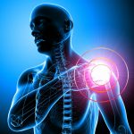 Shoulder Pain Relief – Tips to Get Rid of Shoulder Pain